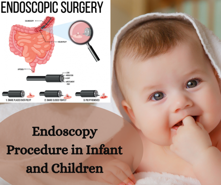Endoscopy Procedure in Infant and Children Dr. Vishesh Dikshit