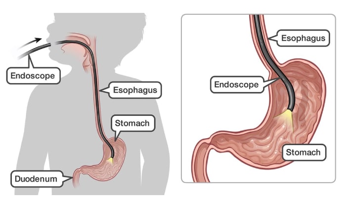 Surgical Endoscopy