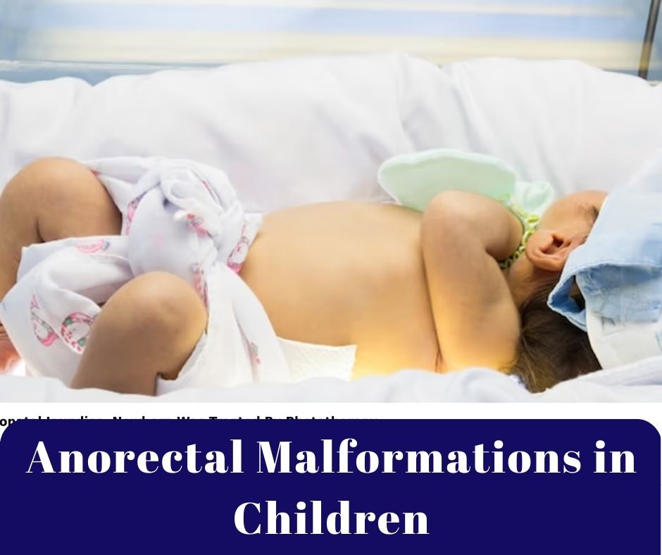 Anorectal Malformations in Children | Dr. Vishesh Dikshit