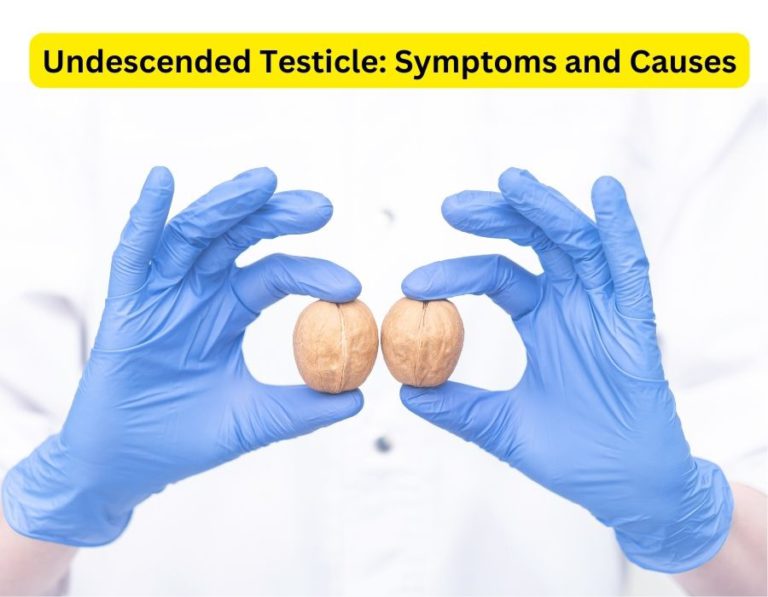 Undescended Testicle Symptoms and Causes Dr. Vishesh Dikshit